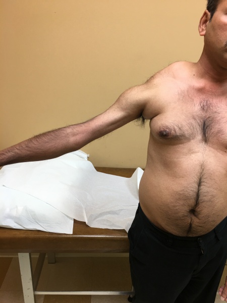 File:Popeye arm.jpg